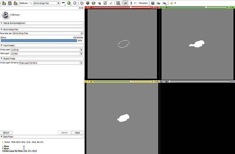 File:Slicer Shrink Wrap Screenshot.jpg
