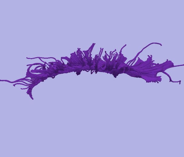 File:CaseD0688 L dil9 sens1.jpg