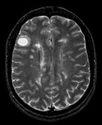 this is a passive image to which the calculated transform is applied. It is a label-map in the same space as the moving FLAIR image