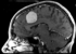 RegLib C01: Tumor change assessment