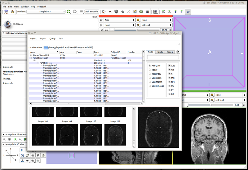 File:Slicer4-dicomtent-2011-06-02.png