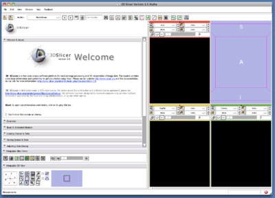 TryVersion2 SlicerStartUp.png