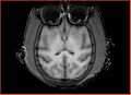 Thumbnail for version as of 00:34, 8 October 2009