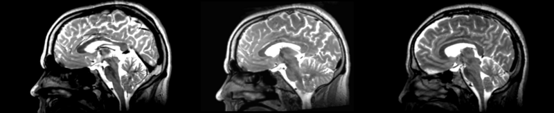 File:53-31 RI pipe rigid.png