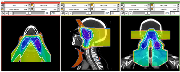 Isodose lines in Slicer 3