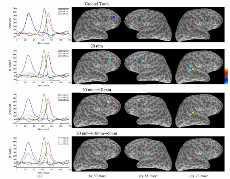File:Ou-Neuroimage2009-fig5.jpg
