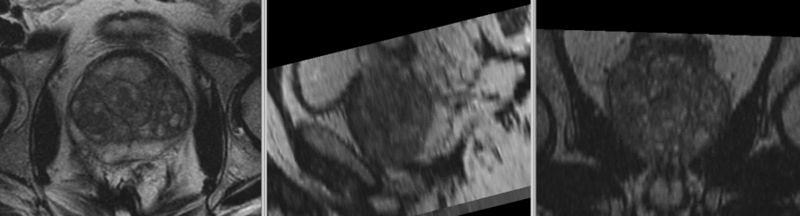 File:RegLib C07 registered Xf1.gif