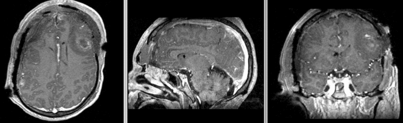 File:RegLib TBI e1 PD-T1.gif