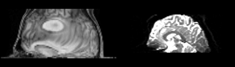 File:Anna t1-baseline bspline.png