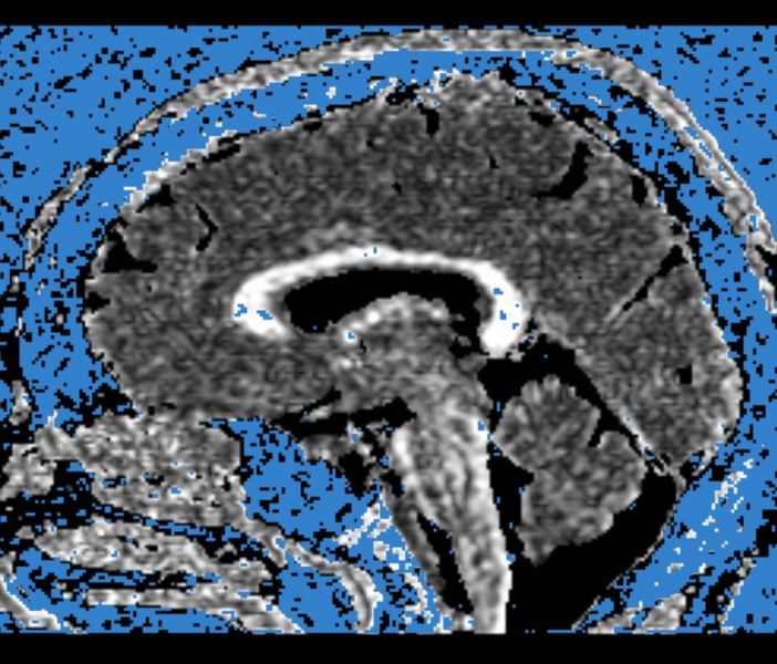 File:CaseD00724 A2.jpg