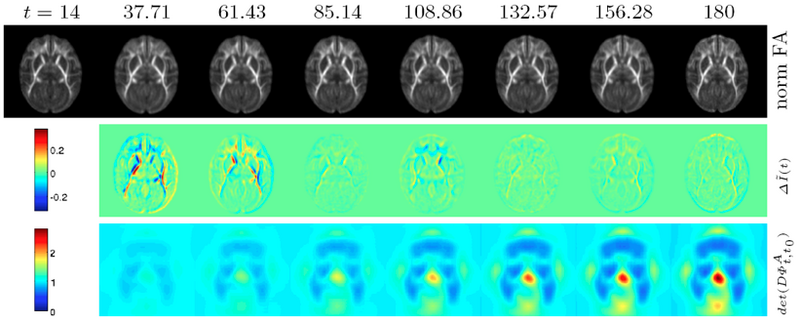 File:UNC longitudinalAtlasEx1.png