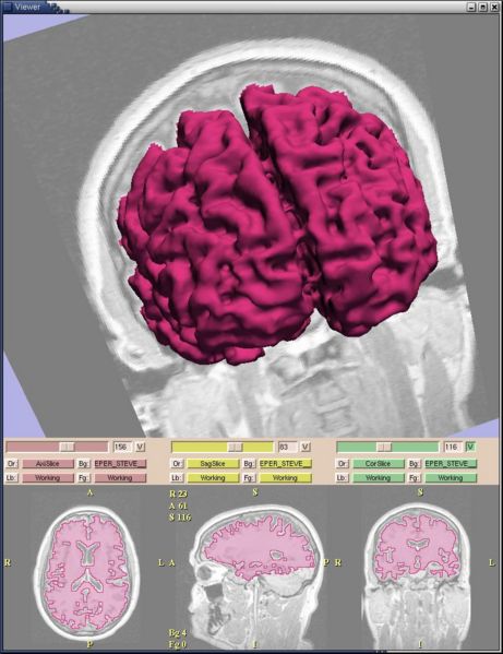 File:Gatech SlicerModel2.jpg