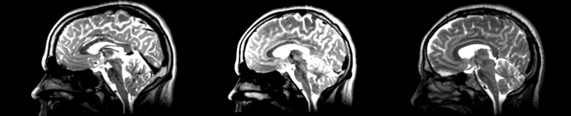 File:53-31 RI pipe bspline.png