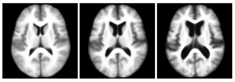 File:Three templates oasis.png