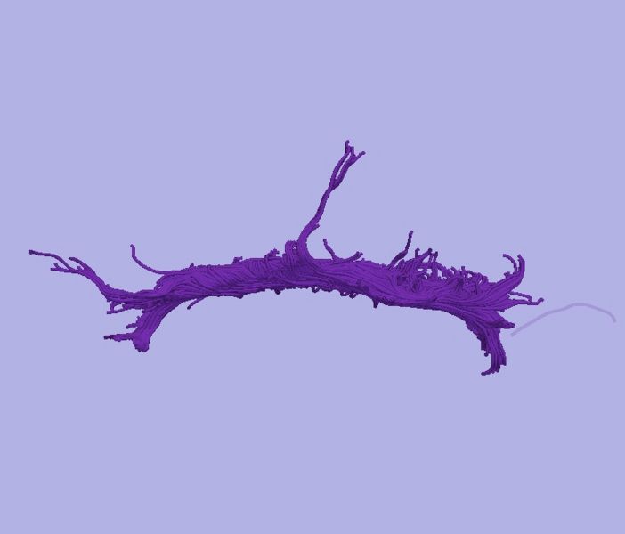 File:CaseD00724 L dil7 sens1.jpg