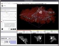 Astrocyte Visualized in Slicer