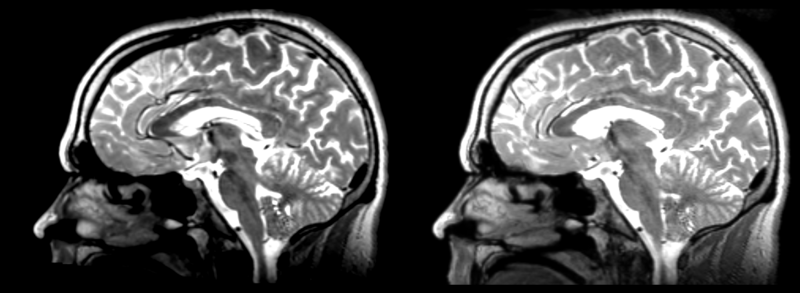 File:53-t2 RI pipe rigid.png