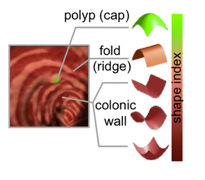 Virtual Colonoscopy Auto Detection - Yoshida.png