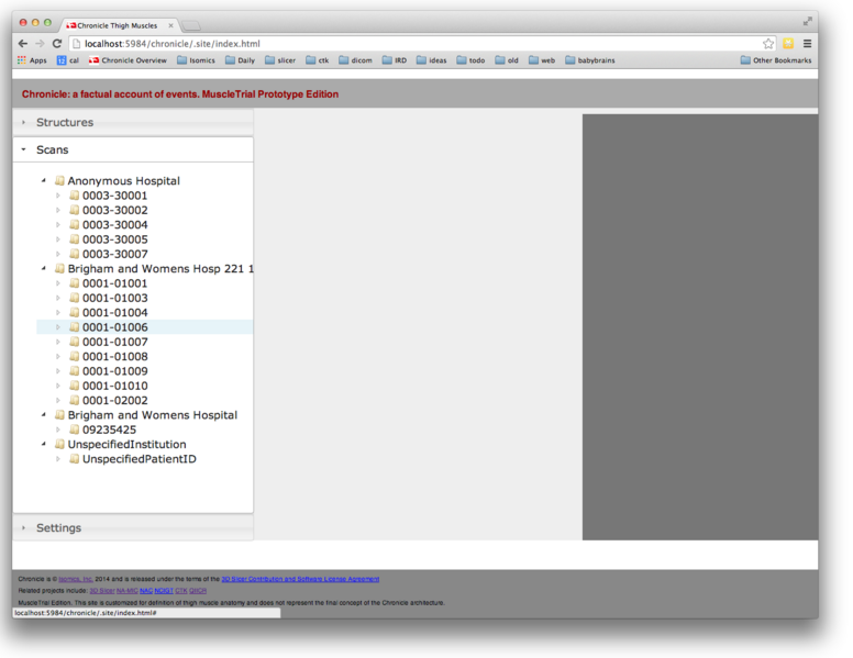 File:Chronicle-muscles scan-select-2014-05-22.png