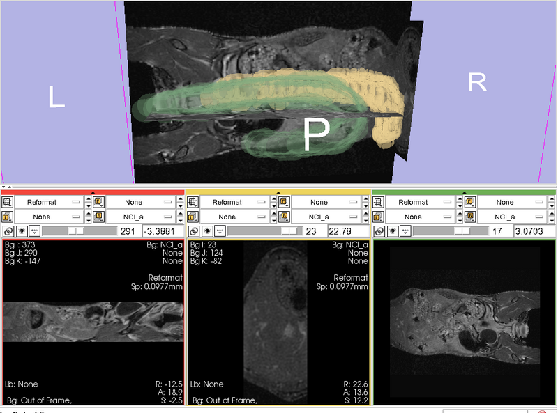 File:MouseColon progress.png