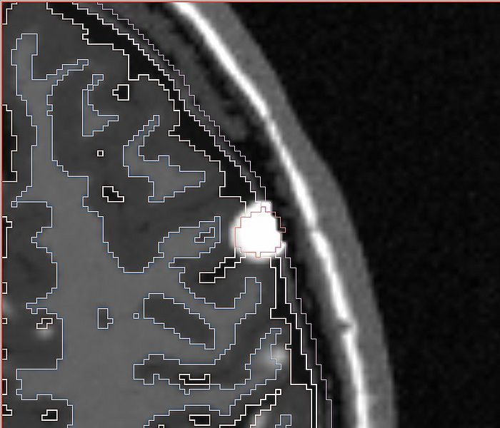 File:Ts rc4 p0.5 gad.jpg