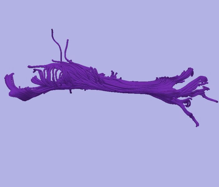 File:CaseD0608 L dil5 sens20.jpg