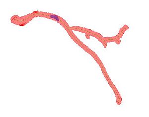 3D visualization of vessel segmentation