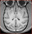 Thumbnail for version as of 15:23, 5 October 2009