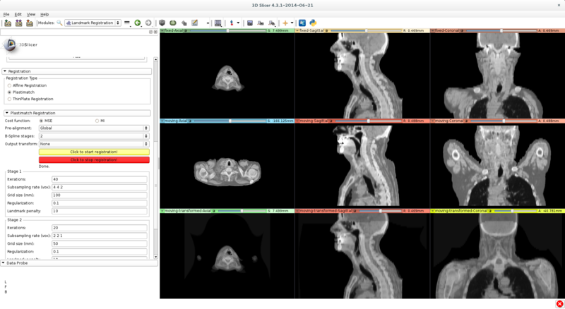 File:Stoppable reg.png