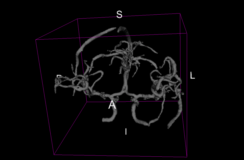File:Surface.png