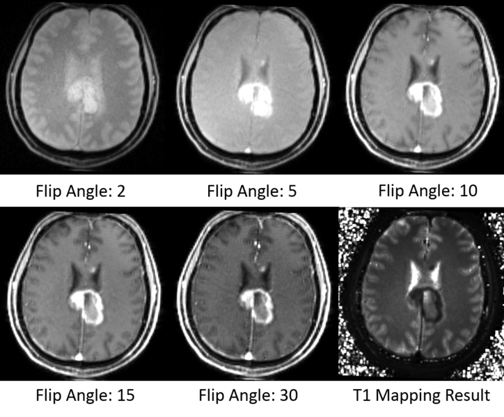 File:T1 Mapping Result Sample.png