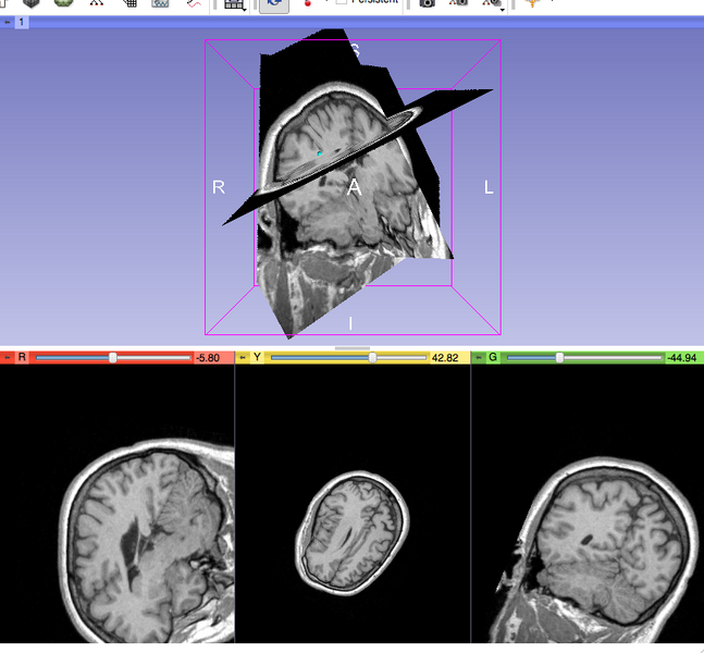 File:SummerProjectWeek2012 OpenIGTLinkIF 1.png