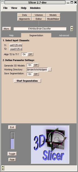 Figure 1: The EMAtlasBrainClassifier Module user interface in Slicer