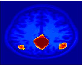 Mit fmri clustering Seed PCC.jpeg