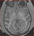 Thumbnail for version as of 15:22, 5 October 2009