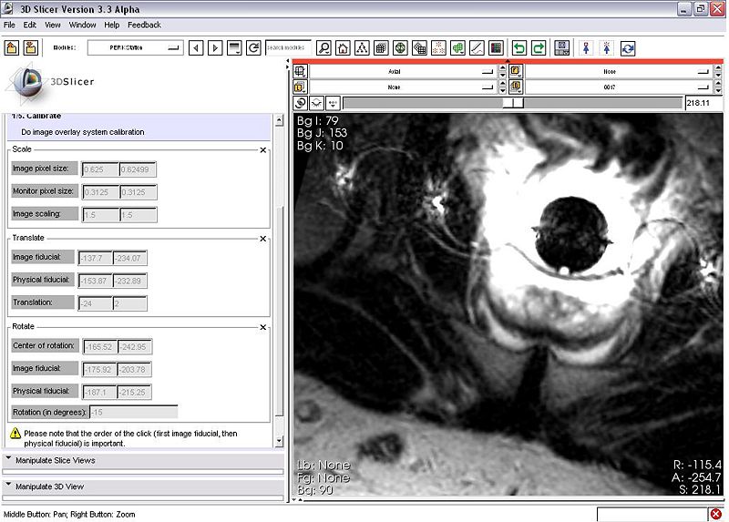 File:PerkStationNAMIC ActualTransform.JPG