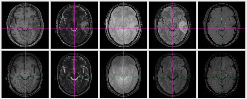 File:Co-registration result No3.png