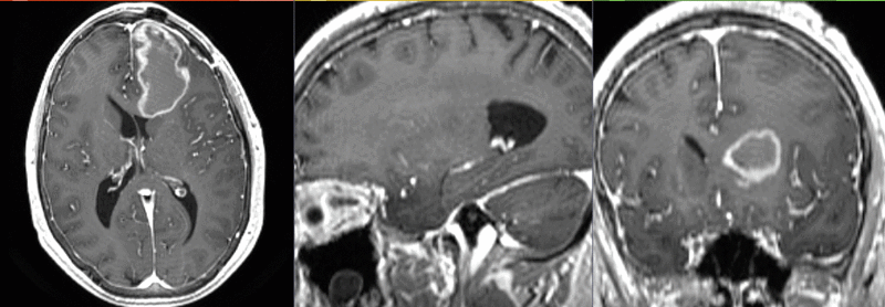 File:RegLib C33 registeredDTI.gif