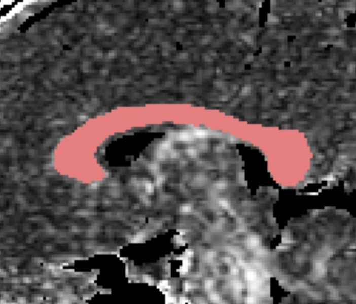 File:CaseD20 oldROI0001.jpg