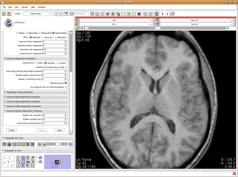 File:RegisterImages-Normal002-004-bspline2-results-2008-07-30.png