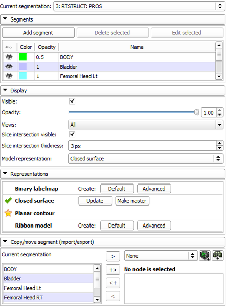 File:SegmentationsModuleUI v01.png