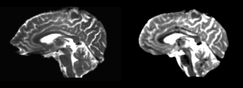 File:T2-base masked rigid-linear.png