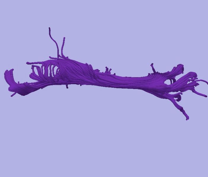 File:CaseD0608 L dil9 sens20.jpg