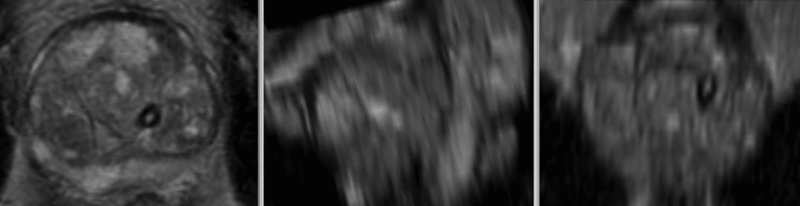 File:RegLib C07 registered Xf2.gif