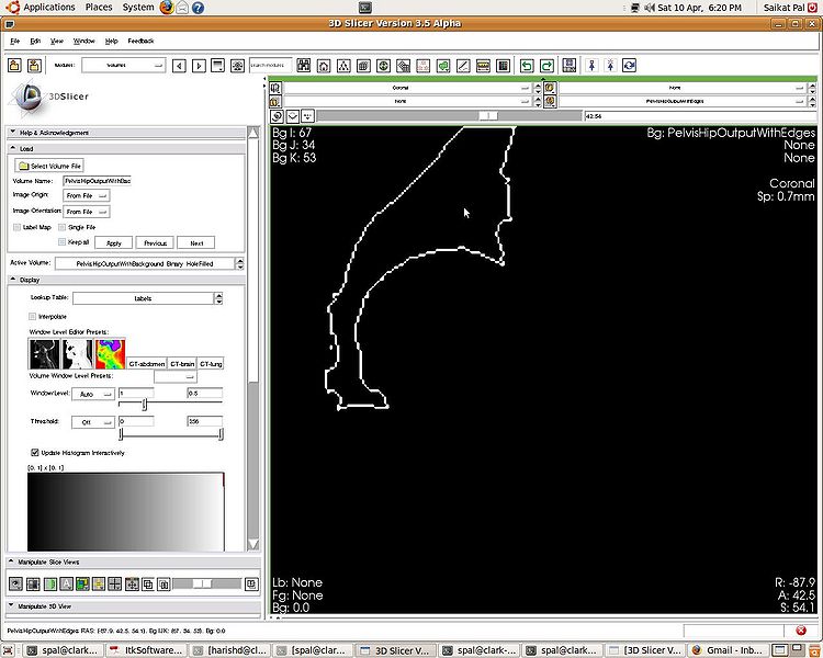 File:07 acetabularcup outline.JPG