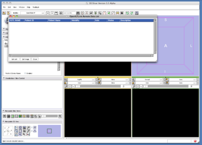 TryVersion2 SlicerRemoteDataListWindow.png