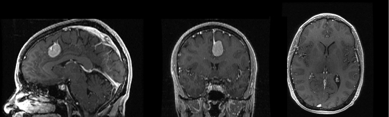 File:RegGif3plane 2reg.gif