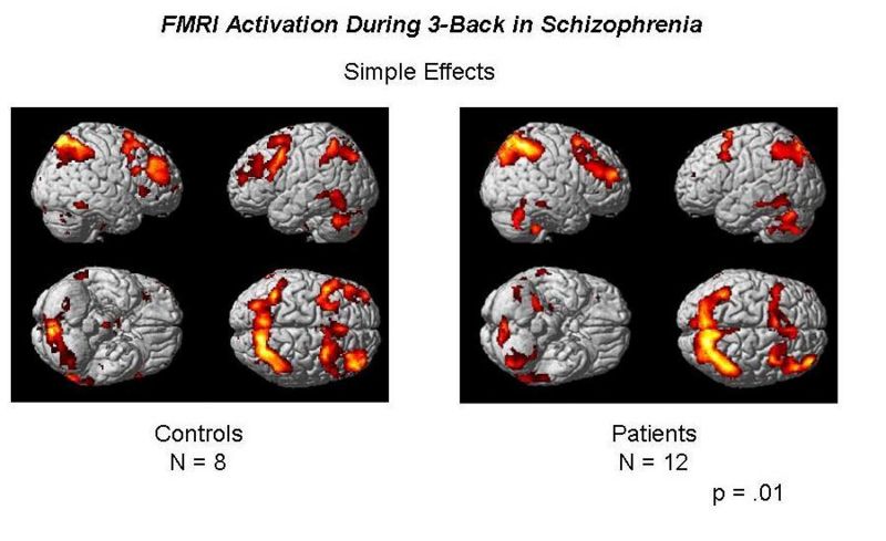 File:NAMIC prelim n2bk results.jpg