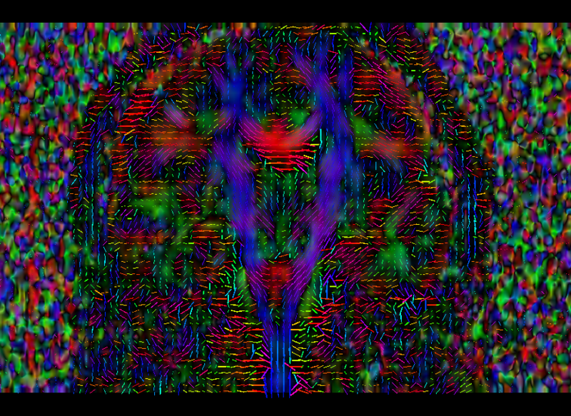 File:Acute QCed dti1.png