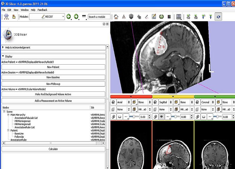 File:Slicer4-RECIST-ProjectWeekSummer2011.jpg
